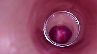Female Insemination - Internal Camera Captures Deep Male Ejaculation