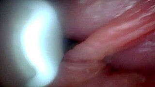 endoscope camera explores penis sensitive parts educational