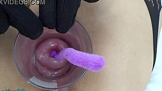 지친 밀프 자궁 깊숙이 엔도스코프 검사로 보지 들여다봄