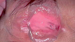 my pink area looks fresh 271 days post first time