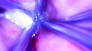 Speculum and microcamera for lady soniac